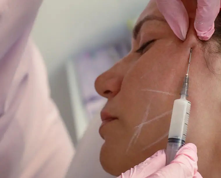 Bioestimuladores de colágeno na VOSS Dermatologia