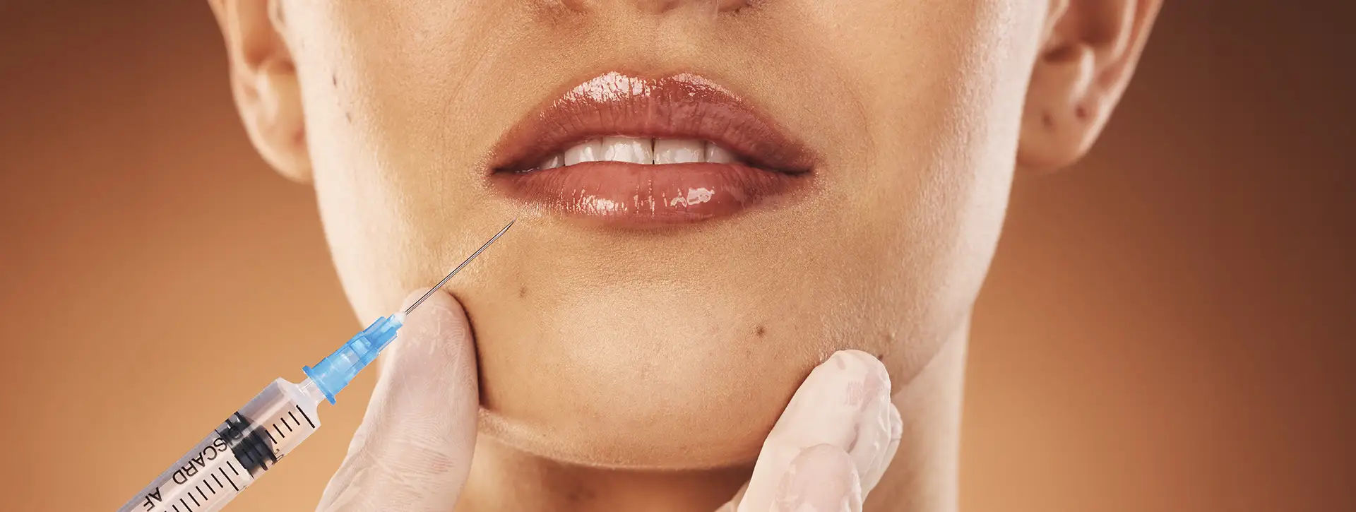 Toxina Botulínica — Dermatologia Estética VOSS Dermatologia