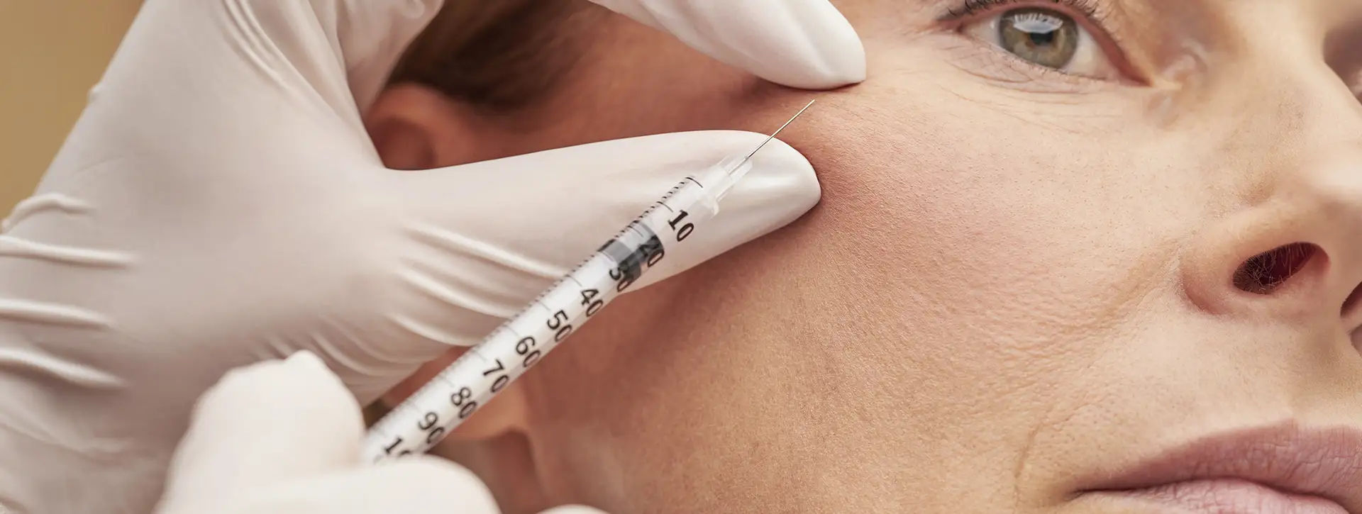 Bioestimuladores de Colágeno — Dermatologia Estética VOSS Dermatologia