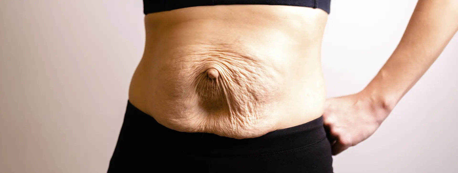 Flacidez Facial e Corporal — Dermatologia Estética VOSS Dermatologia