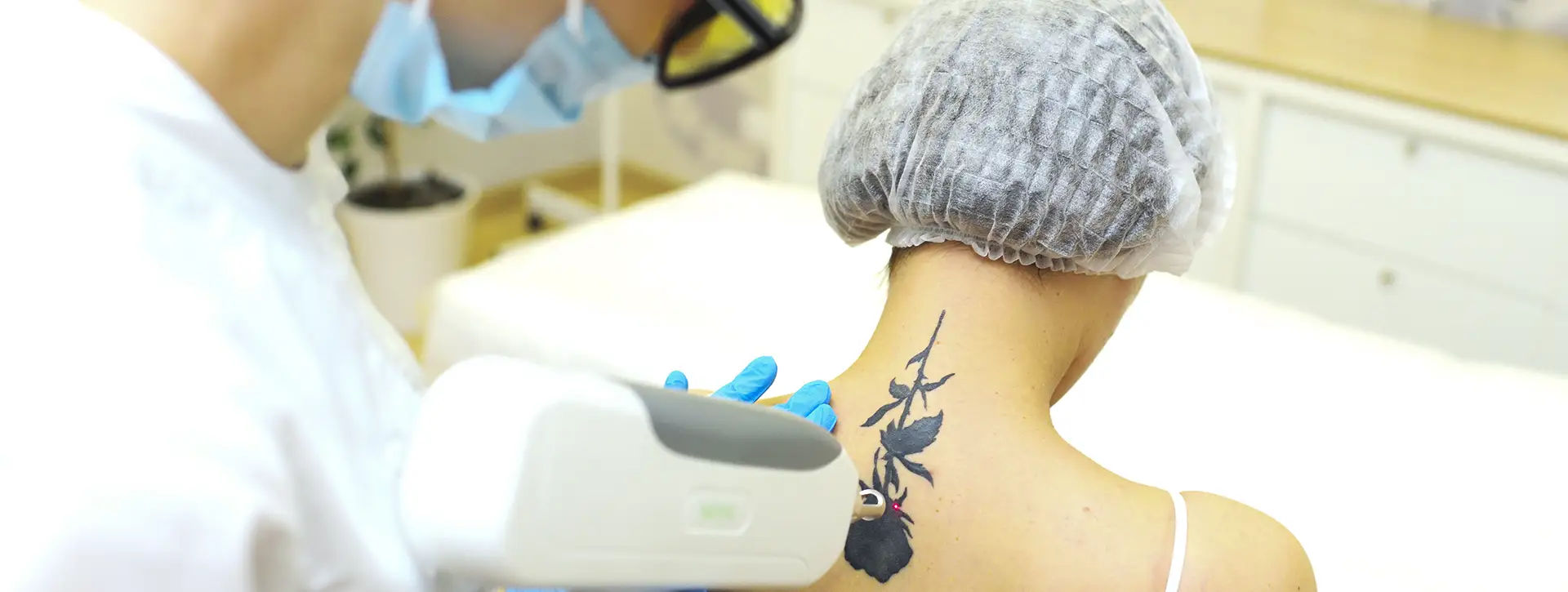 Remoção de Tatuagem — Dermatologia Estética VOSS Dermatologia