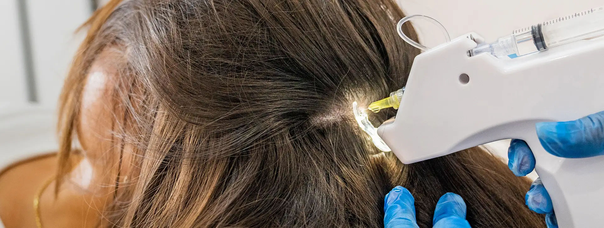 MMP (Microinfusão de Medicamentos) — Tecnologias e Inovações VOSS Dermatologia