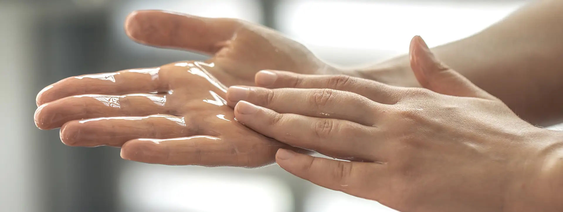 Hiperidrose — Dermatologia Clínica VOSS Dermatologia